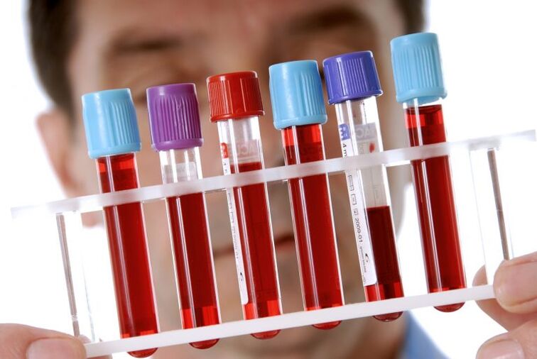 Tests sanguins pour le diagnostic des helminthiases
